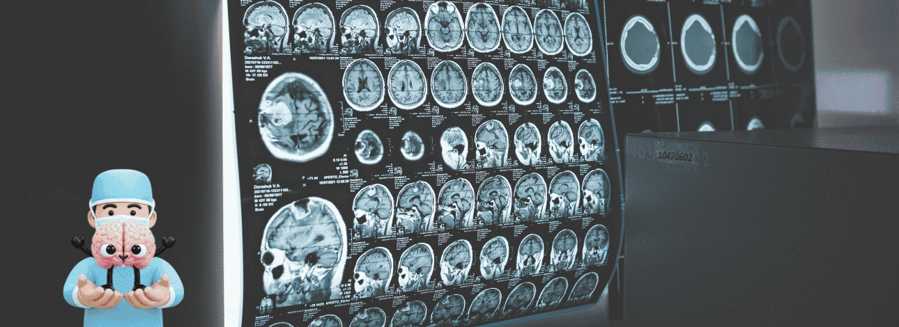 Resultado de exame cerebral