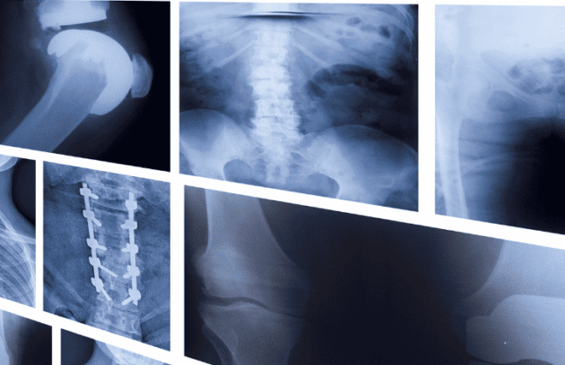 Raio-x com os ossos do corpo