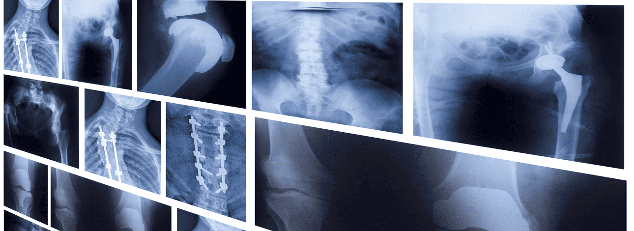 Raio-x com os ossos do corpo