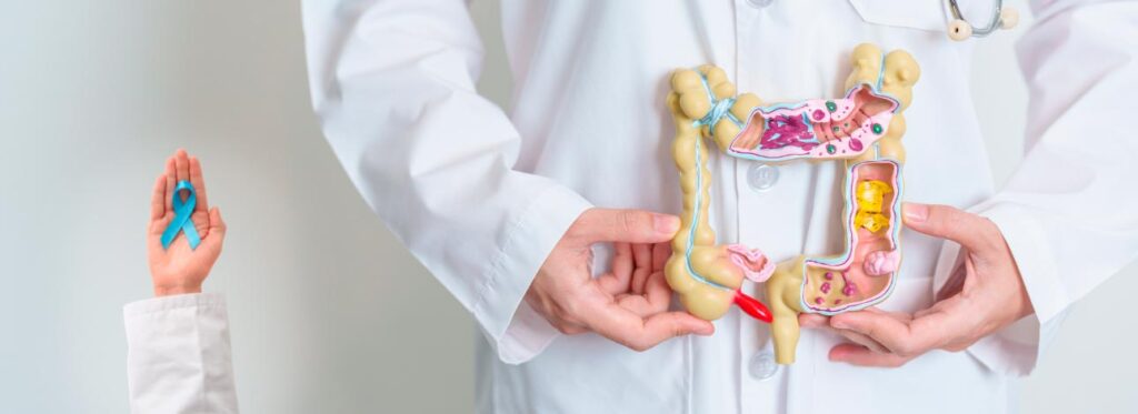 Médico segurando a ilustração de um intestino