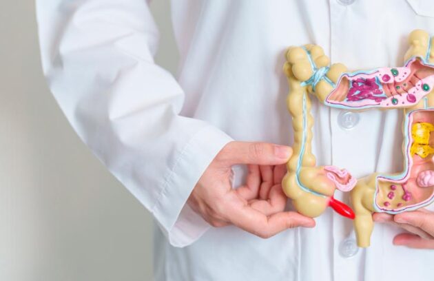 Médico segurando a ilustração de um intestino