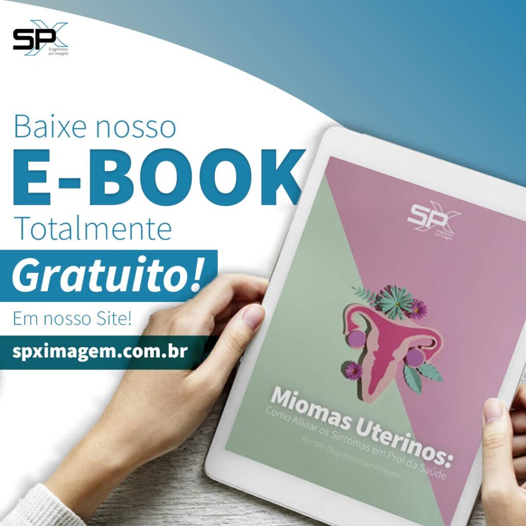 Divulgação do e-book da SPX Diagnóstico por Imagem sobre miomas uterinos