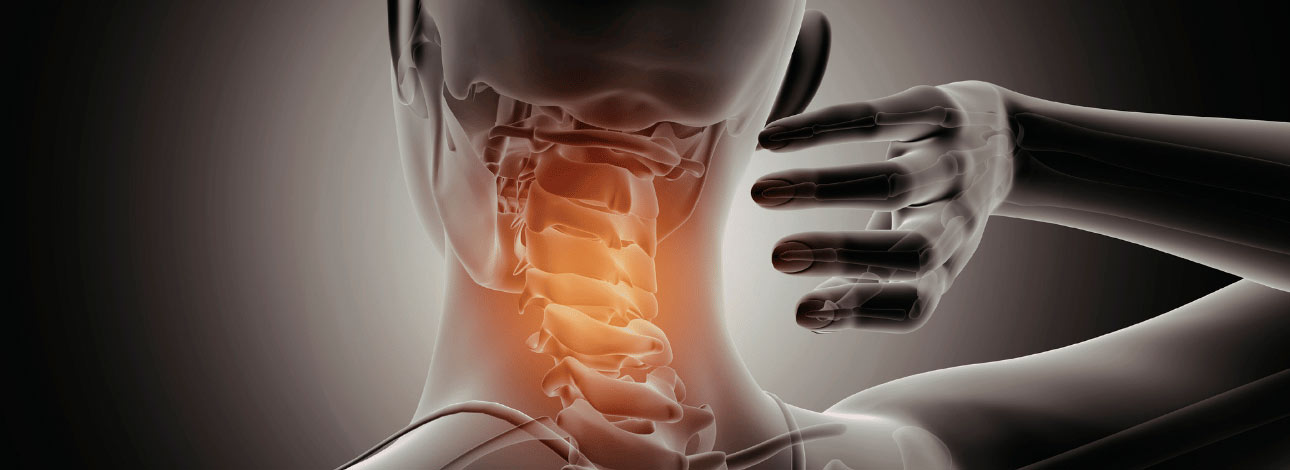Representação de neoplasia cervical