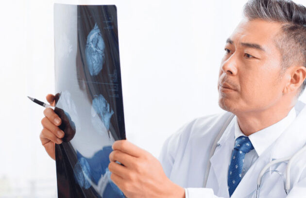 Médico radiologista analisa um exame de Raio-X