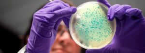 Análise de placas de cultura bacteriana por uma pesquisadora em um laboratório de microbiologia