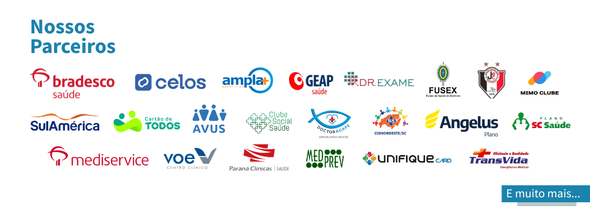 Banner convênios aceitos na SPX Joinville