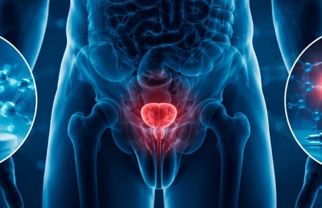 Representação da próstata ao lado de medicamentos e terapia hormonal