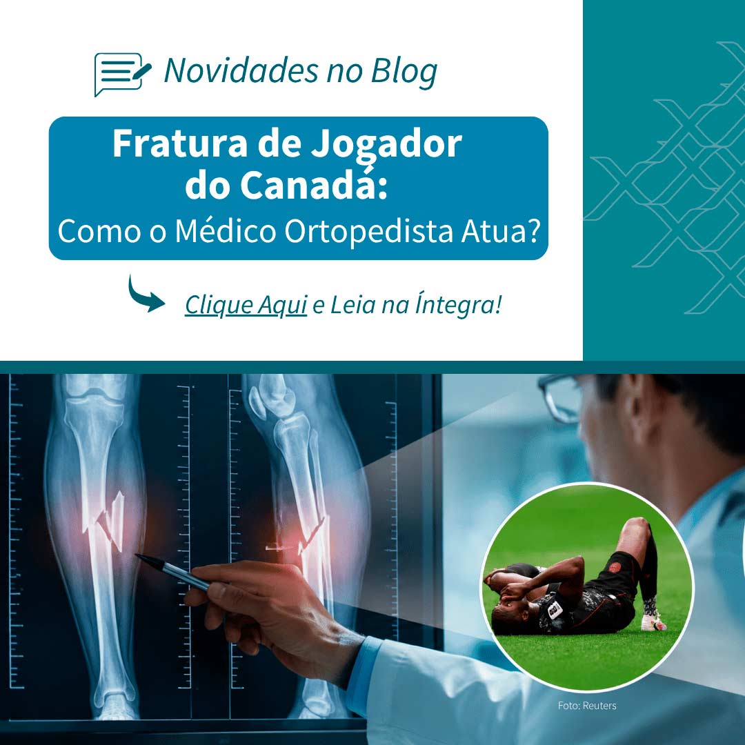 Fratura de Jogador do Canadá: Como o Médico Ortopedista Atua?