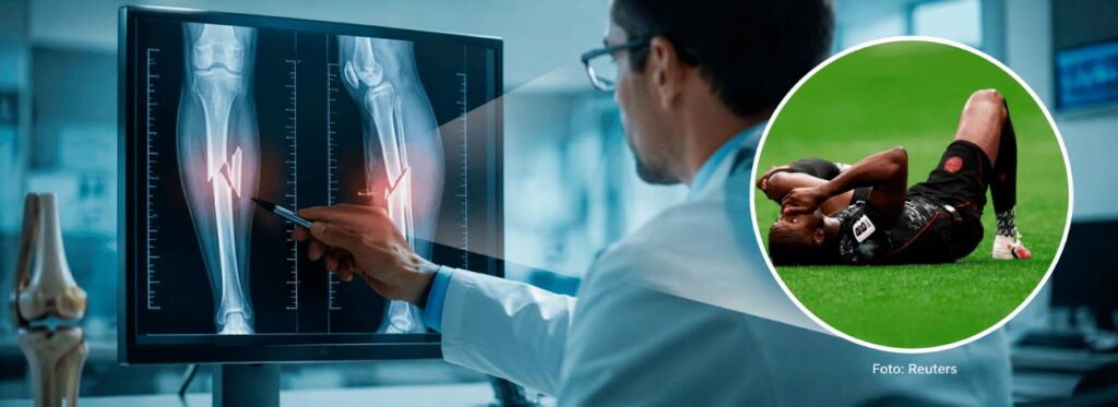 Médico ortopedista analisando uma fratura grave na perna