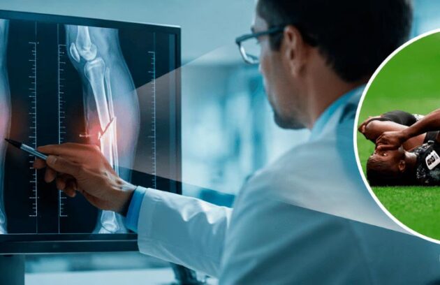 Médico ortopedista analisando uma fratura grave na perna