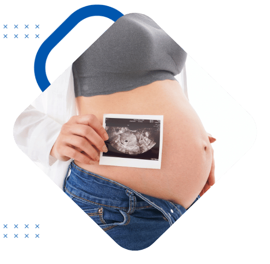 Ultrassom obstétrico, morfológico, doppler obstétrico e ultrassom 3D na SPX Taubaté