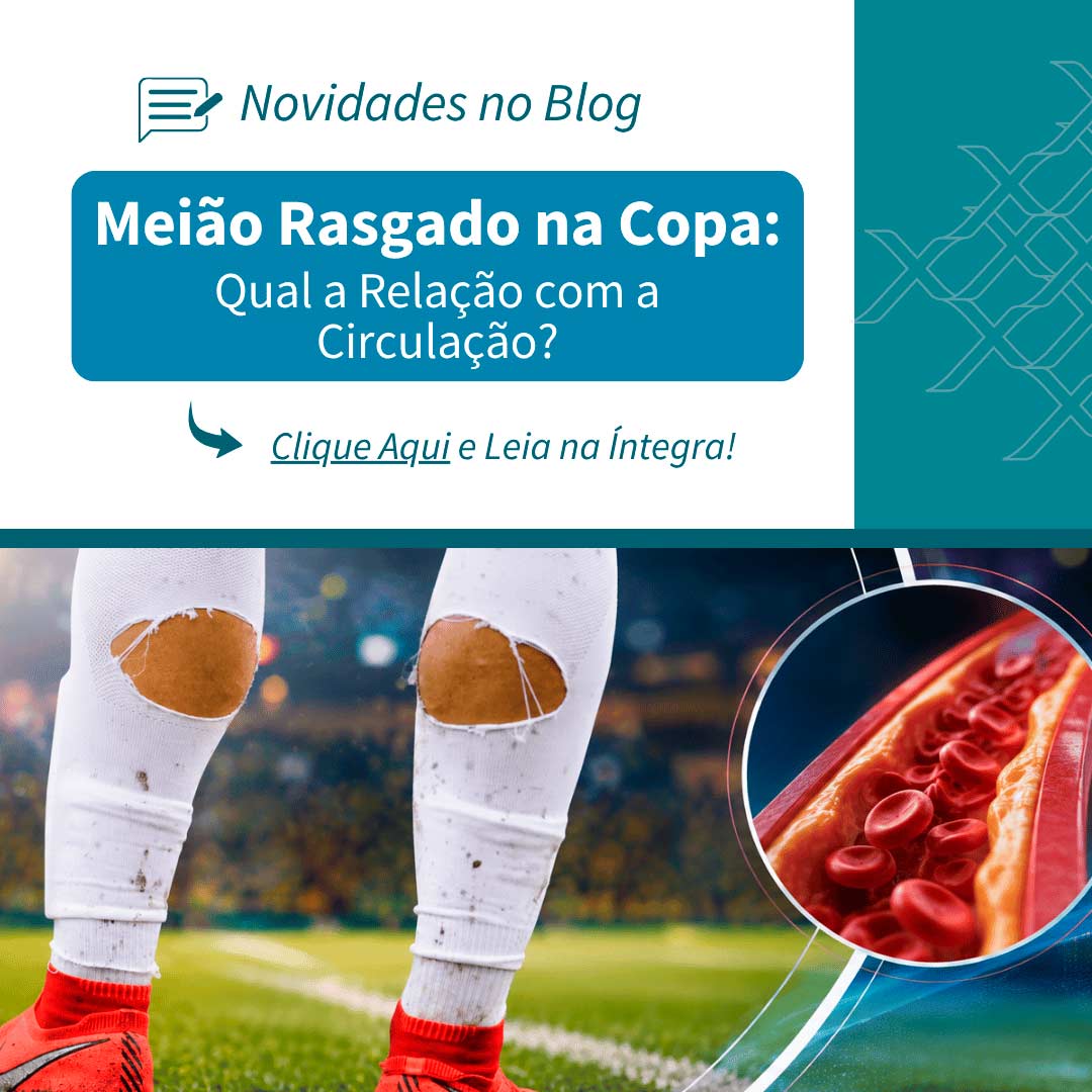 Meião Rasgado na Copa: Qual a Relação com a Circulação?