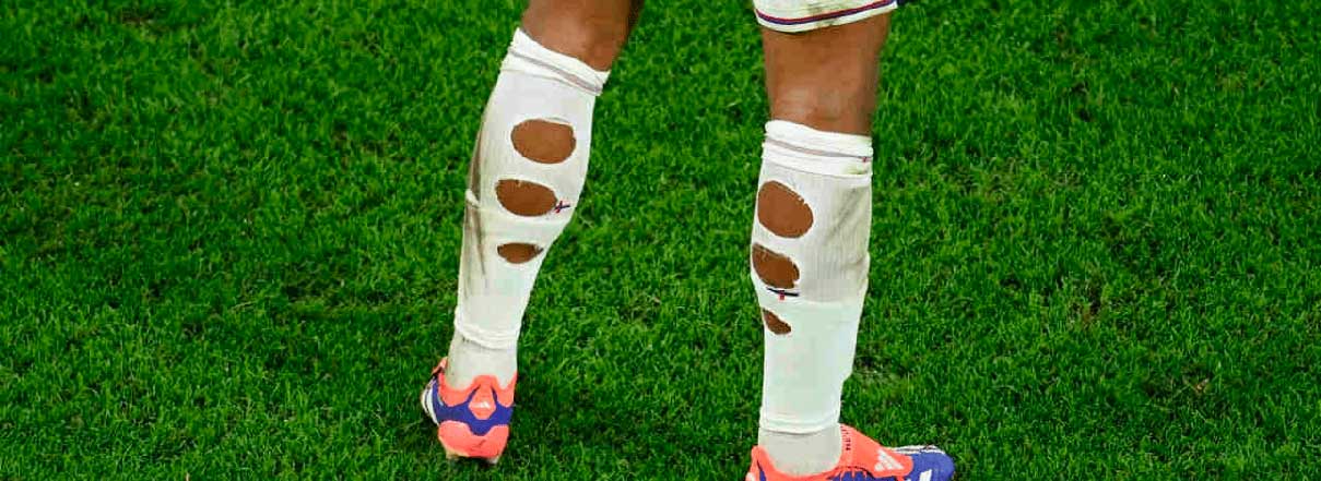 Jogador de futebol com o meião rasgado durante uma partida