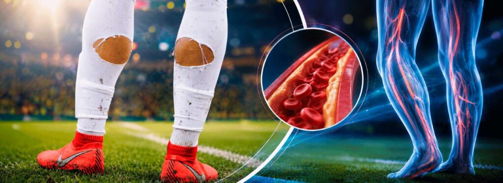 Jogador de futebol com o meião rasgado