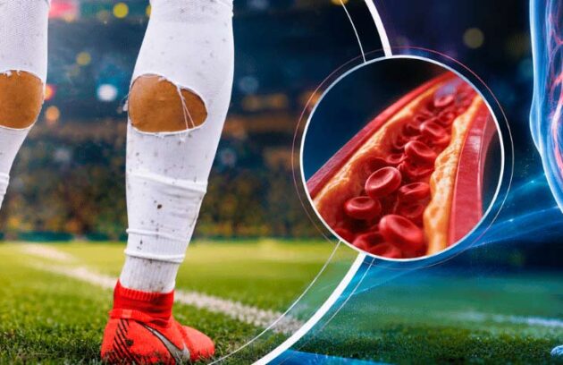 Jogador de futebol com o meião rasgado