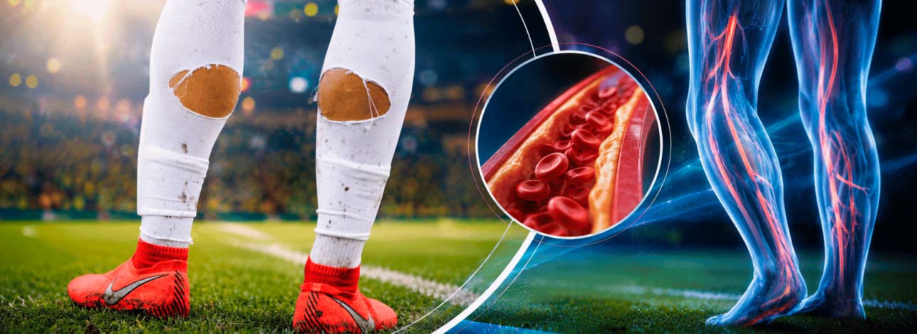 Jogador de futebol com o meião rasgado