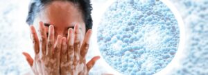 Mulher com vitiligo com fundo de célula