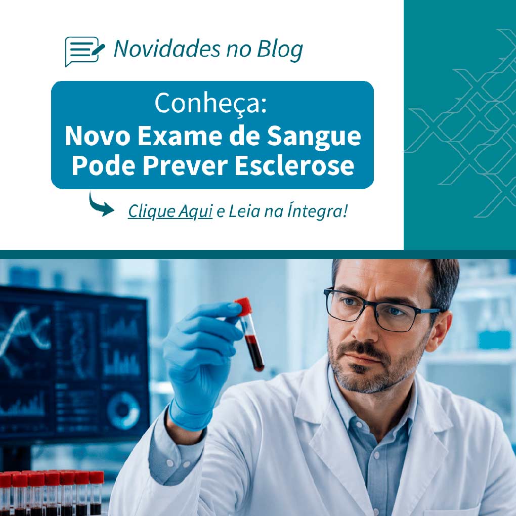 Novo Exame de Sangue Pode Prever Esclerose; Conheça