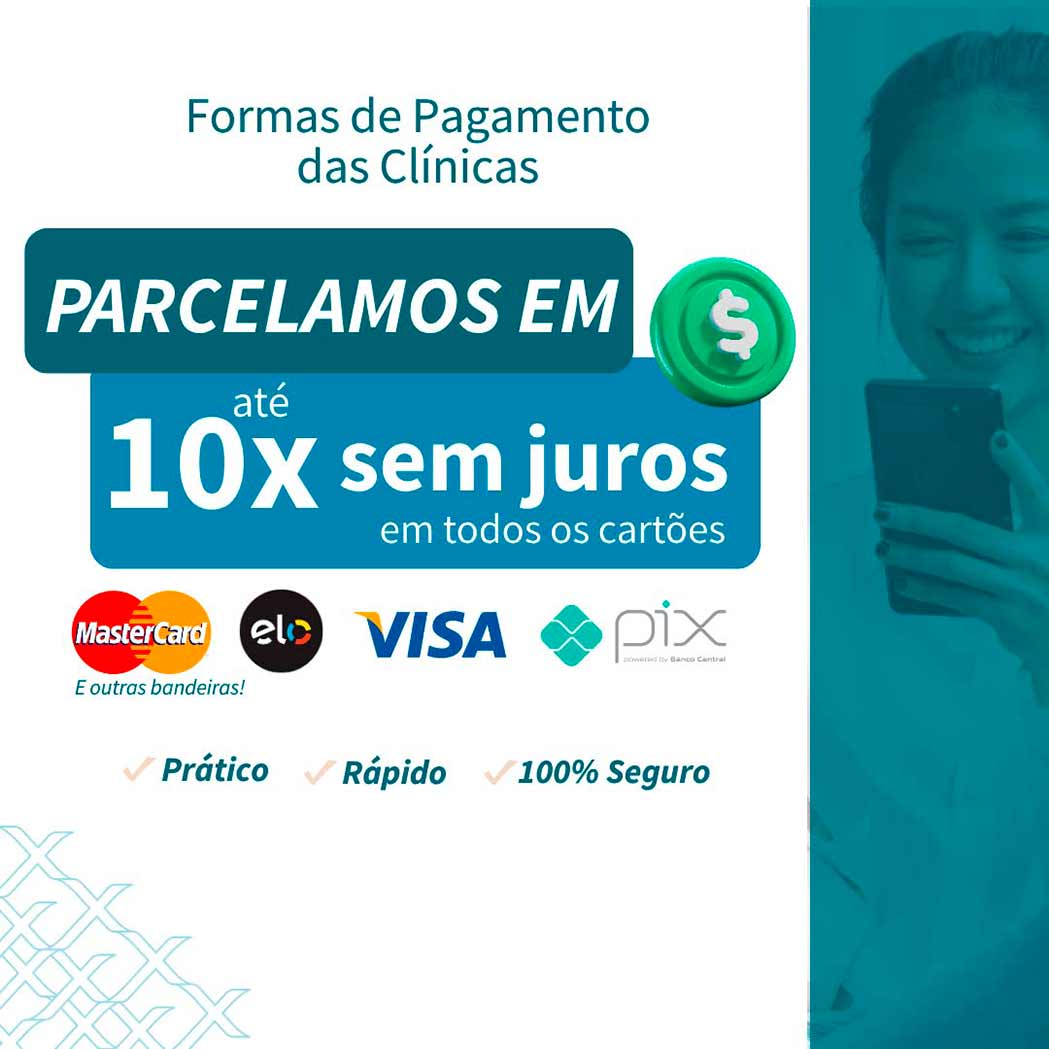 Formas de pagamento da SPX Imagem