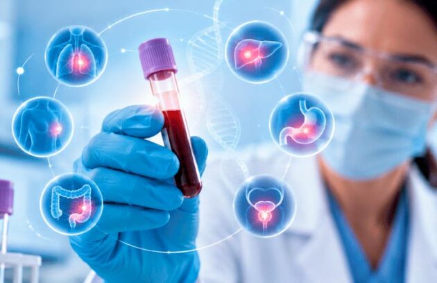 Cientista analisando exame de sangue para marcadores tumorais